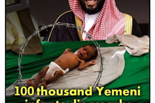100 thousand Yemeni infants die yearly  Due to medication and pharmaceutical siege by the Saudi regime