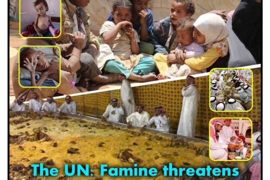 The UN: Famine threatens the lives of two million Yemeni children
