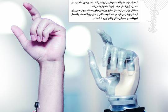پوستر: دستاوردهای انقلاب اسلامی ایران دومین کشور دارنده دانش ساخت پروتز عصبی
