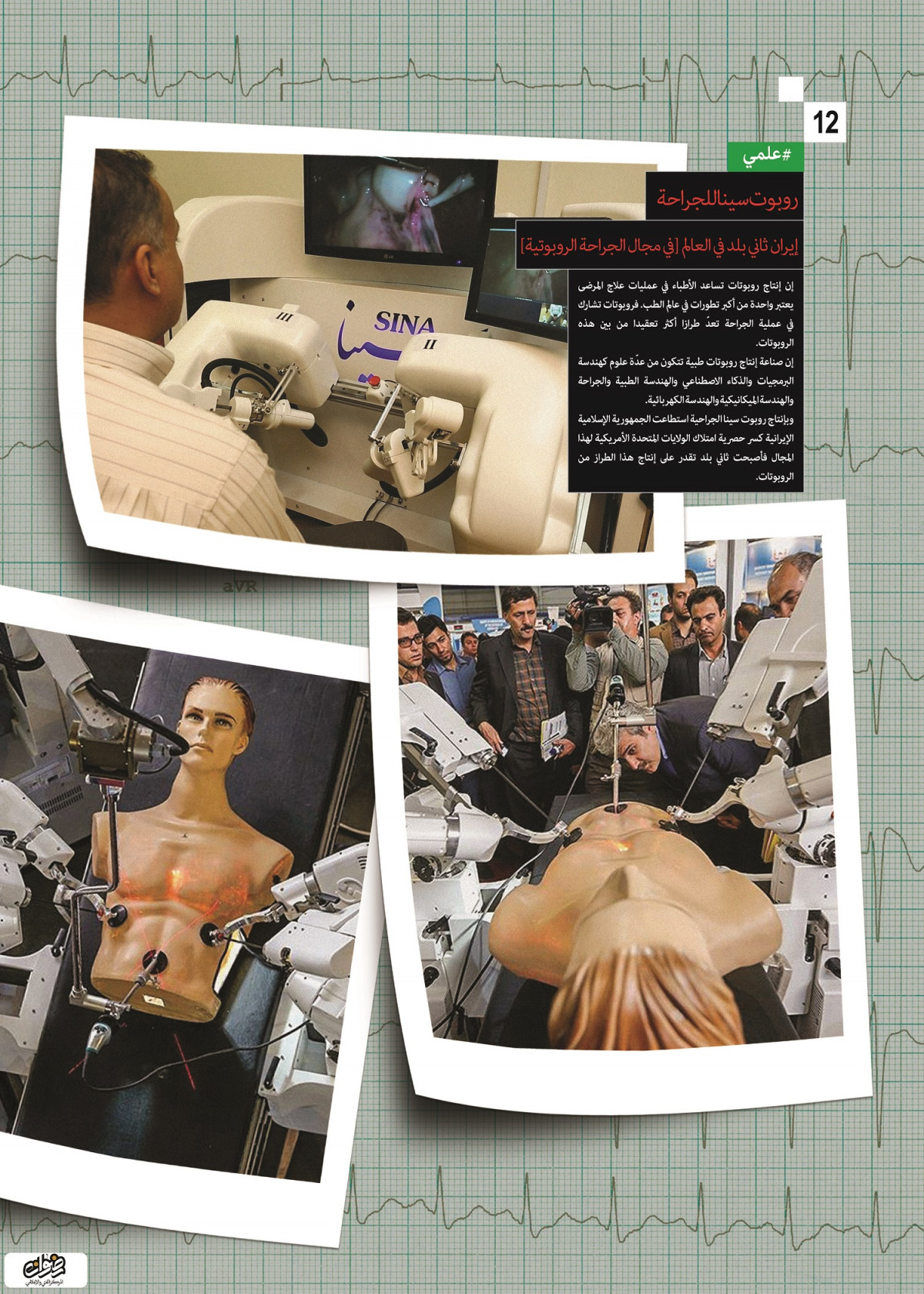 إنجازات العلمية / روبوت سينا للجراحة إيران ثاني بلد في العالم [في مجال الجراحة الروبوتية ]