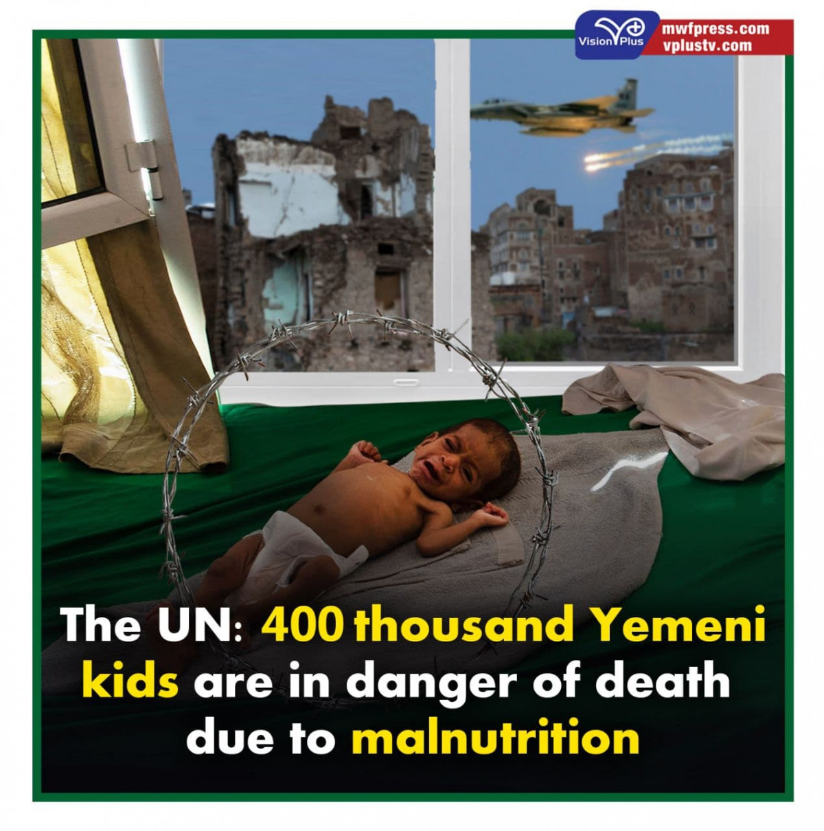 The UN: 400 thousand Yemeni kids are in danger of death due to malnutrition