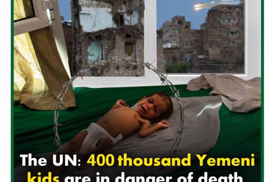 The UN: 400 thousand Yemeni kids are in danger of death due to malnutrition