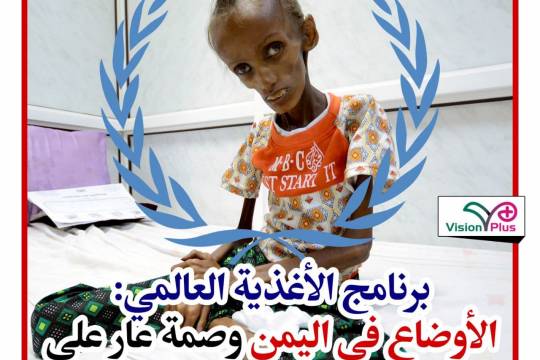 الأوضاع في اليمن وصمة عار على جبين المجتمع الدولي