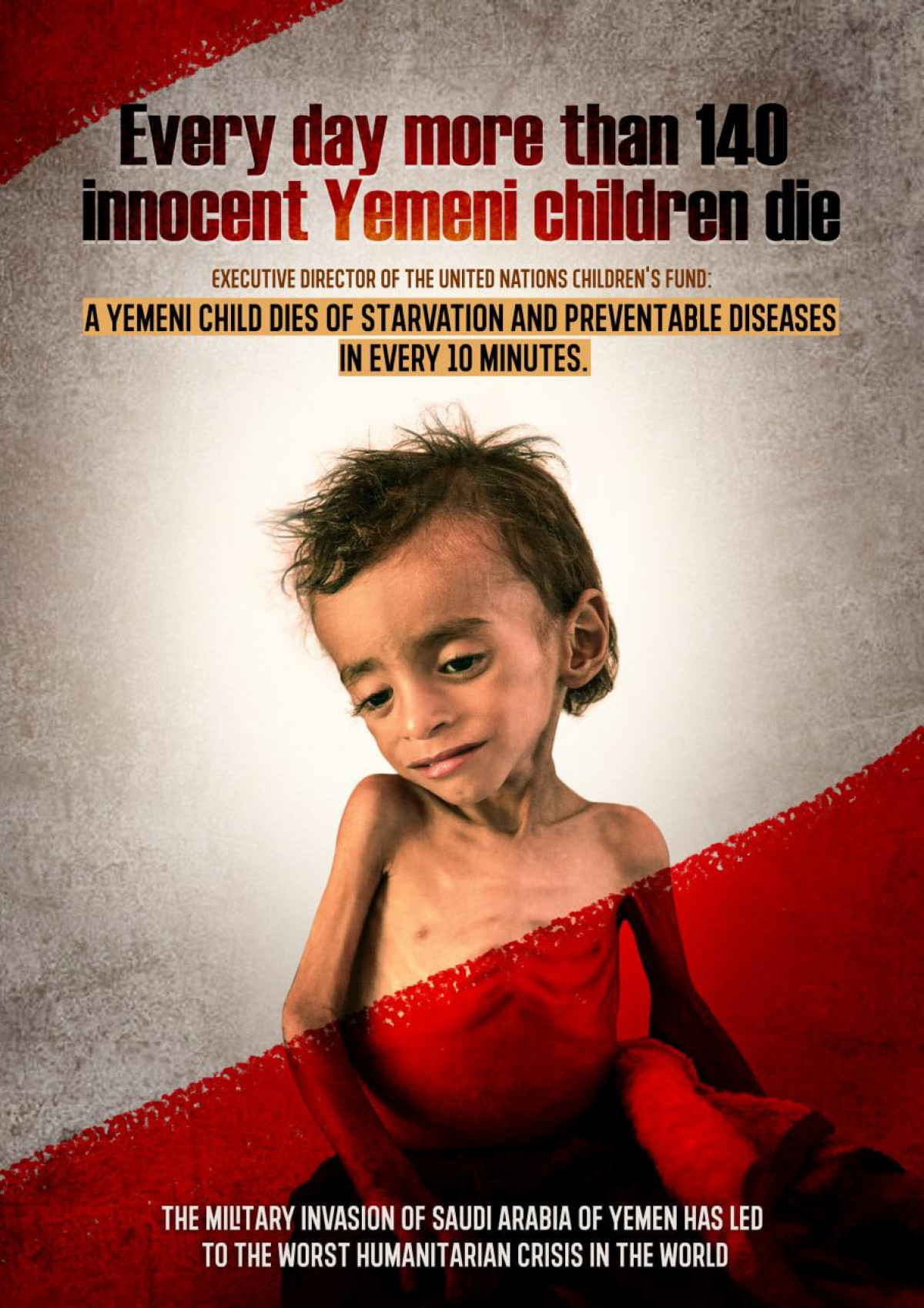 Every day more than 140 innocent Yemeni children die