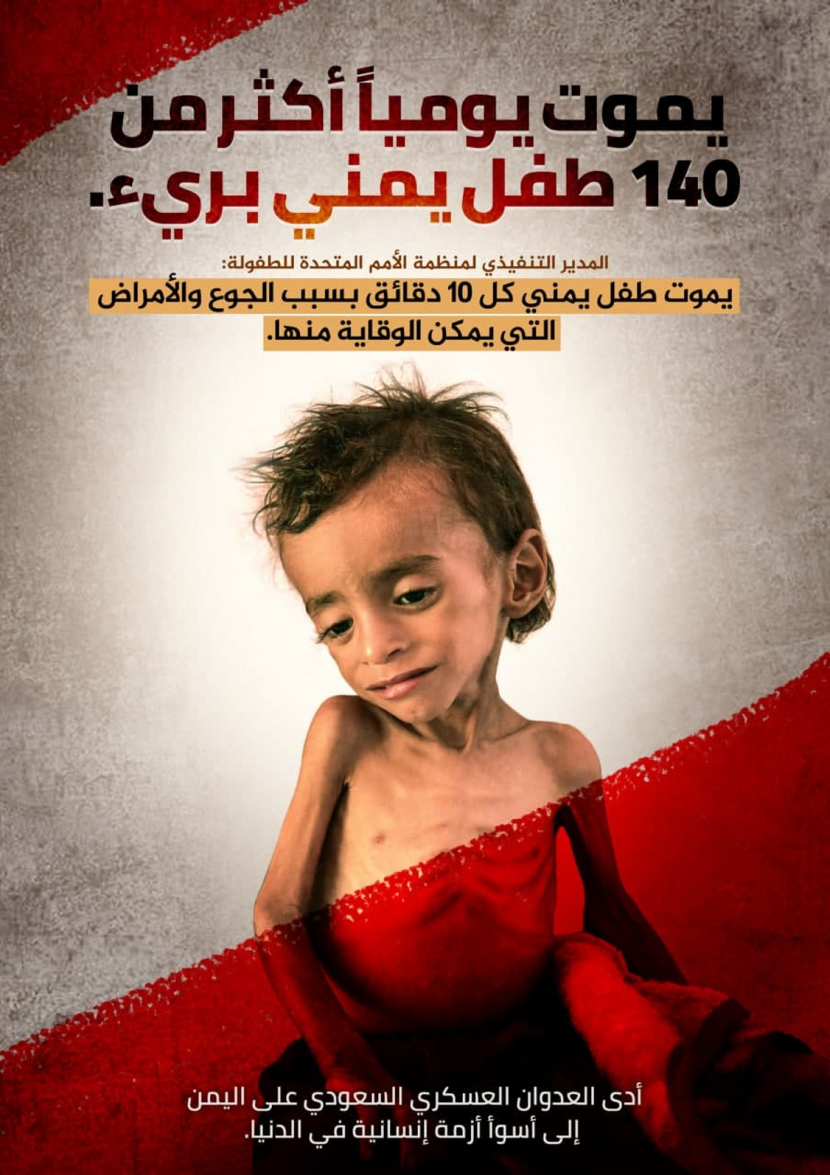 يموت يومياً أكثر من 140 طفل يمني برئ