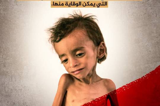 يموت يومياً أكثر من 140 طفل يمني برئ