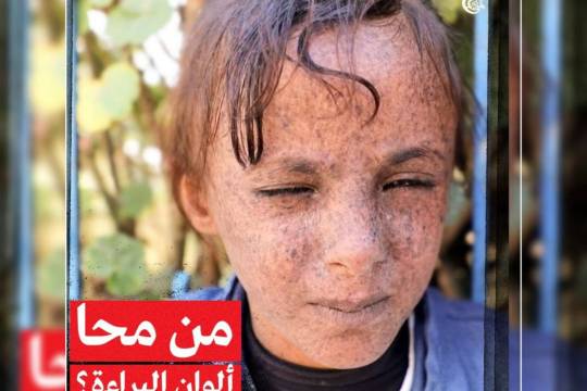 مجموعة بوسترات " هدية السعودية لأطفال اليمن "