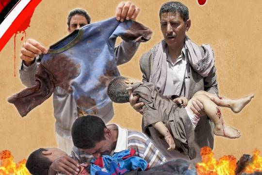 سیر نمایشگاهی جنایات رژیم سعودی و نظام سلطه در یمن 4