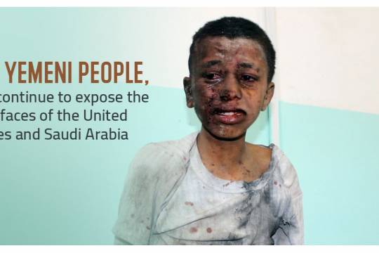we, the Yemen people will continue to expose the ugly faces of the United States and Saudi Arabia.