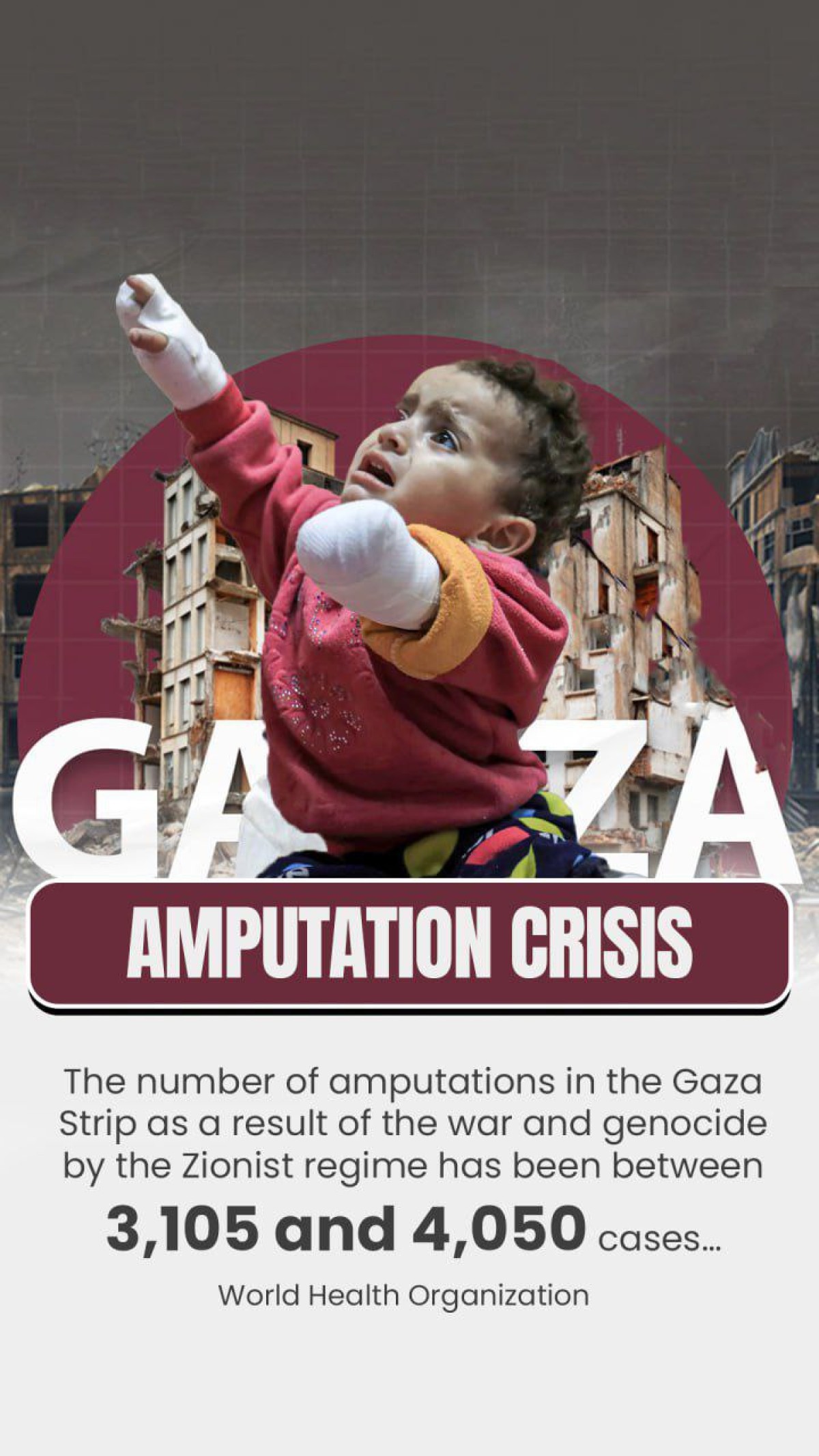 GAZA AMPUTATION CRISIS