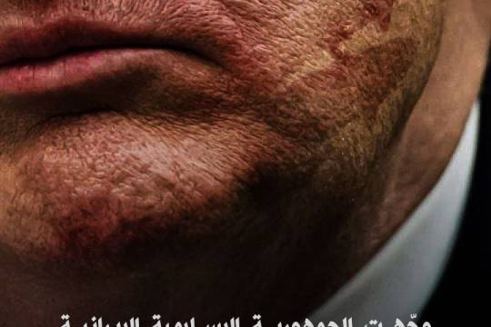 صفعة قوية إلى وجه أمريكا