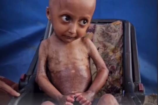 مجموعه موشن استوری : از غزه بگویید سکوت نکنید