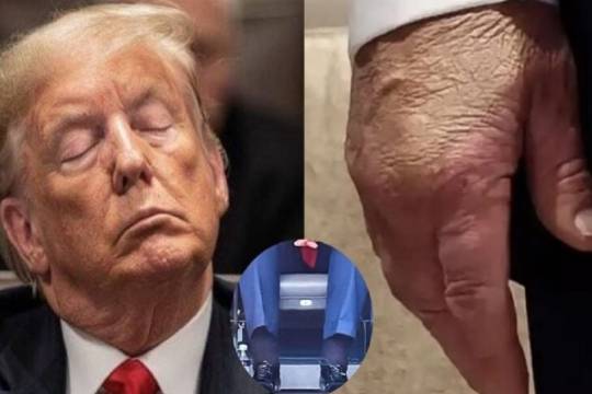 Trump’s COVID Crisis: A Symptom of America’s Decaying Political System"